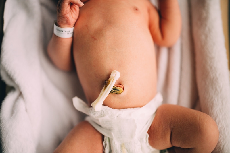 Fresh 48 Newborn Photography, a baby lays in a hospital bassinet with umbilical cord clipped
